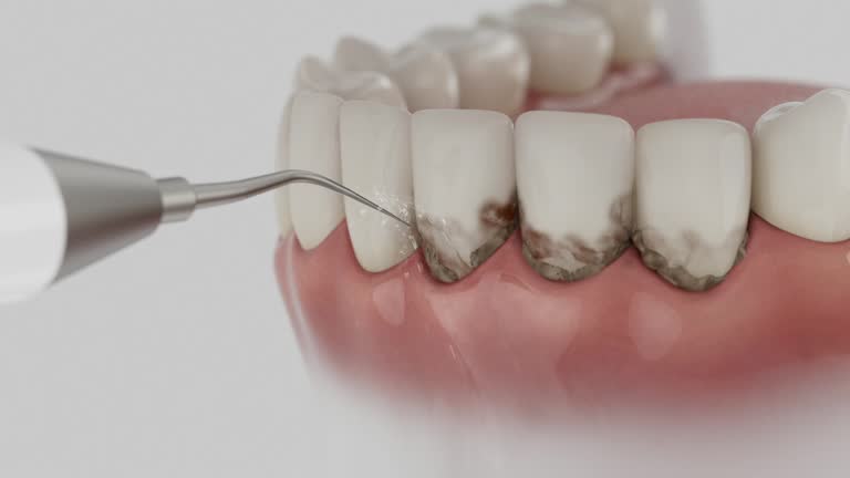 Trusted Teeth Cleaning And Checkup service in Leland Grove, IL - Dentist Open Now